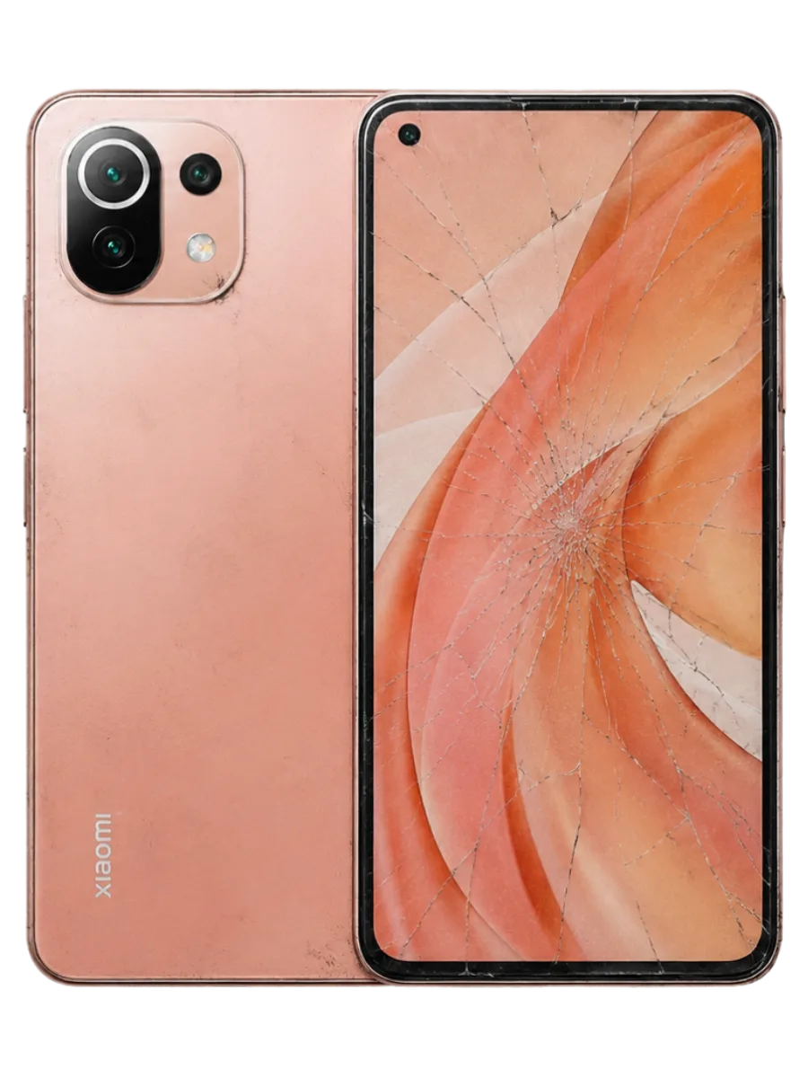 Gambar XIAOMI MI 11 YOUTH